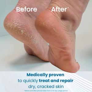Flexitol Heel Balm 56g - gallery image 5