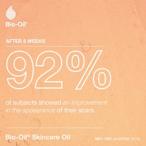 Bio-Oil Skincare Oil 200ml - gallery image 4