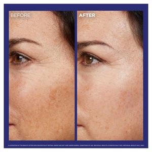 L'Oreal Paris Revitalift Laser Pure Retinol Deep Anti-Wrinkle Night Serum 30ml - gallery image 3