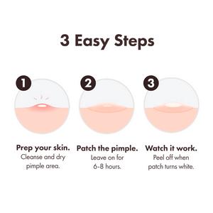 Mighty Patch Duo Pimple Patches From Hero Cosmetics Pimple Patches x12 - gallery image 5