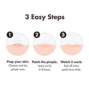 Mighty Patch Invisible+ Spot Patches by Hero Cosmetics Pimple Patches x24 - gallery image 5