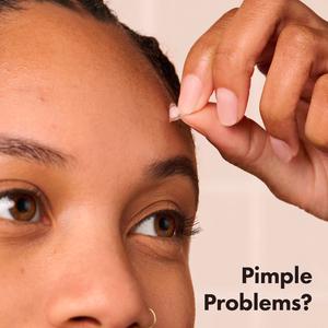 Mighty Patch Invisible+ Spot Patches by Hero Cosmetics Pimple Patches x24 - gallery image 6