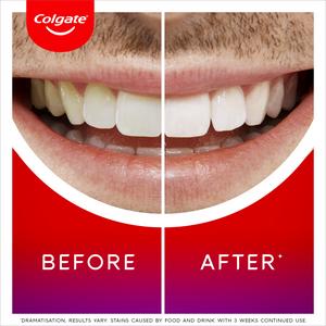 Colgate Max White Overnight Teeth Whitening Serum 2.5ml - gallery image 3