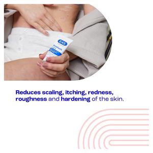 E45 Psoriasis Cream to Reduce Scaling Itching & Relieve Irritated Skin 50ml - gallery image 3