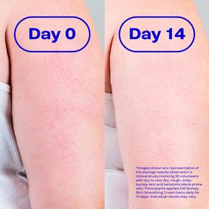 E45 100g Bumpy Skin Smoothing Cream - gallery image 3
