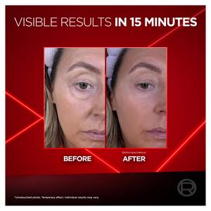L'Oréal Paris Revitalift Laser Instant Eye Bag Eraser - gallery image 3