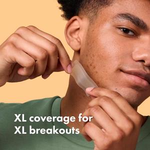 Hero 10 Mighty Surface Spot Pimple Patches - gallery image 5