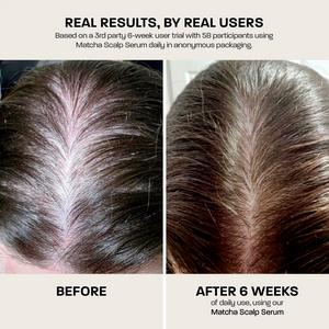 Rehab 90ml Matcha Scalp Serum - gallery image 5