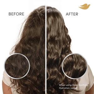 Dove 45ml Scalp + Hair Therapy Soothing Hydration 3 in 1 Scalp Serum - gallery image 5