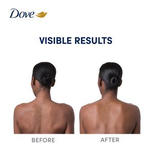 Dove 200ml Niacinamide + Even Tone Body Serum - gallery image 2