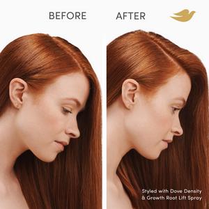 Dove 100ml Density & Growth Root Lift Scalp Therapy Hair Spray - gallery image 6